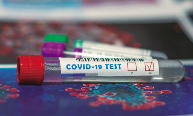 Test de autodiagnóstico de anticuerpos frente al Sars-cov-2 en farmacias